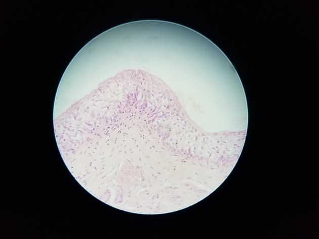 Transitional Epithelium Slides - Transitional Epithelium 04 400X